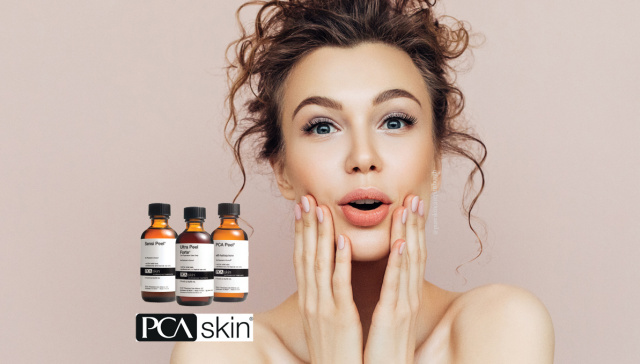 charlotte chemical peel